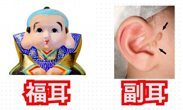 福耳と副耳の違い