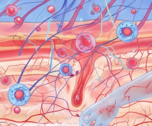 ストレスが引き起こす「かゆみ」の機序