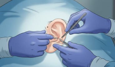 手術は必要？治療法の判断基準