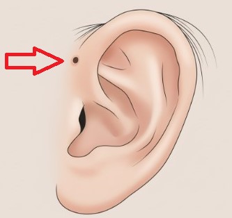 穴が臭い？分泌物の正体