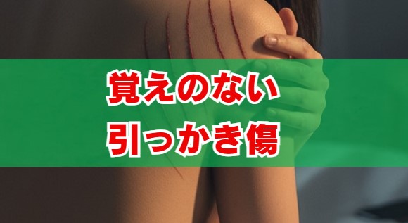 覚えのない引っかき傷とストレス。原因と意味